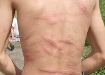 «Били палками, тушили об него окурки»: школьники зверски избили одноклассника в Караганде